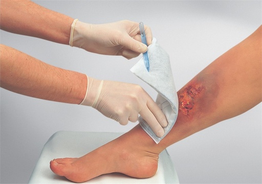 [4021447309347] Curativo Lohmann & Rauscher Vliwaktiv de Carvão Ativado com Prata Esteril 10 X 10 CM 1un